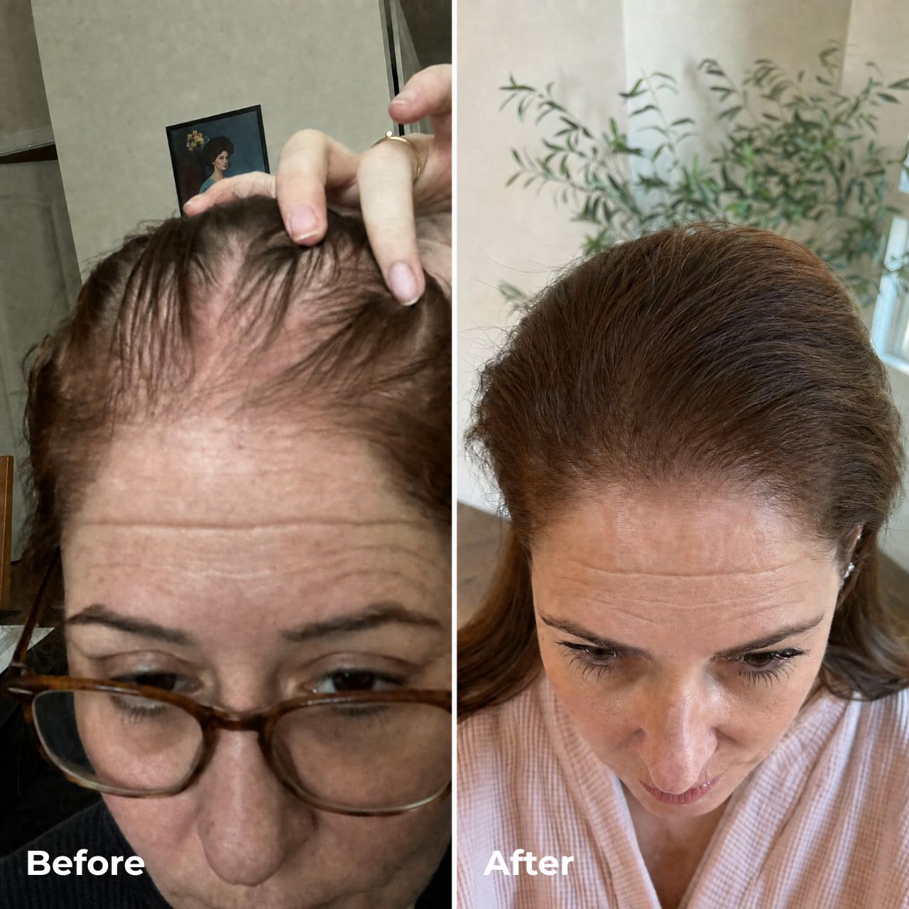 Hair Revive Gummies