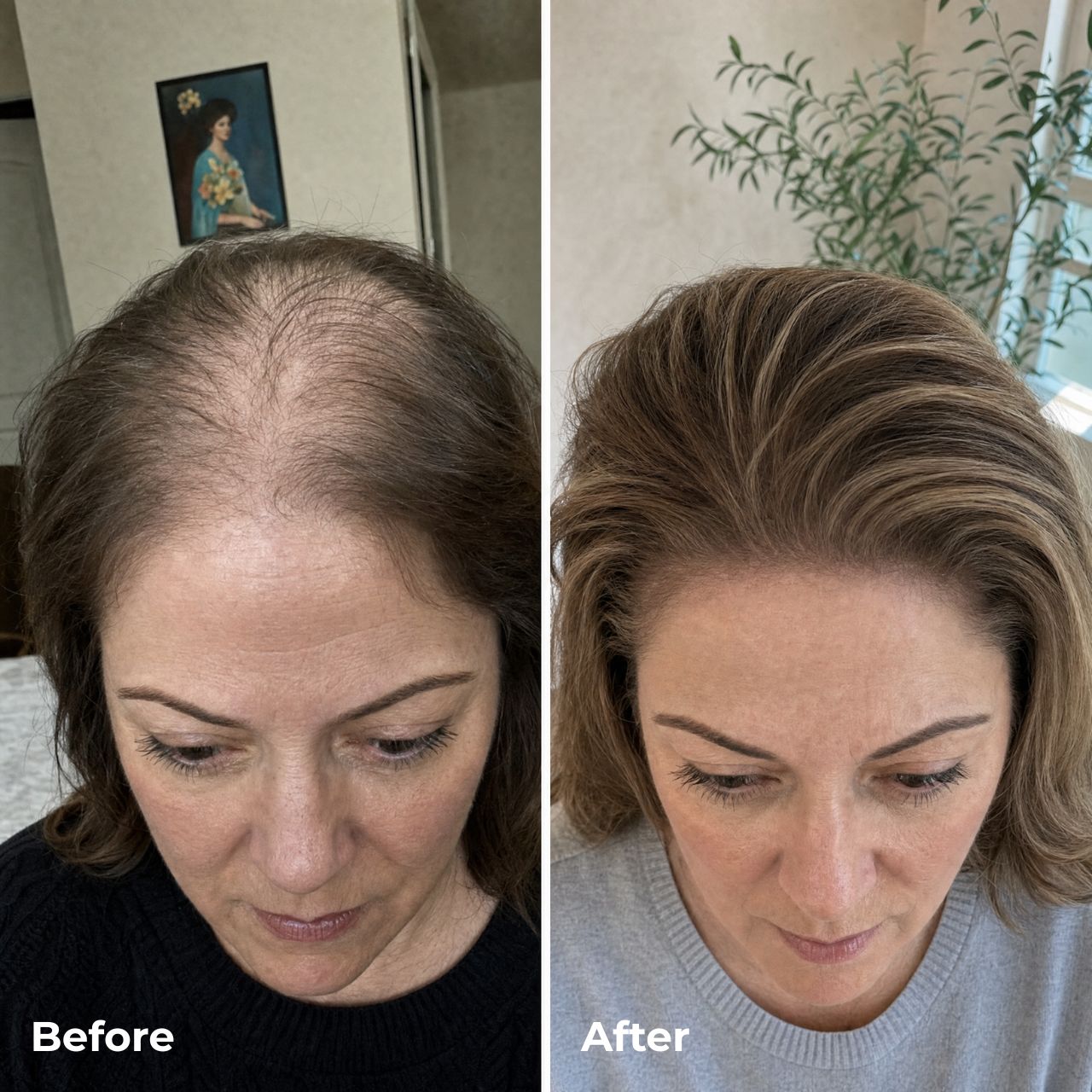 Hair Revive Gummies